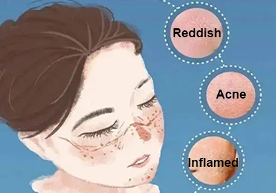 glyceryl glucoside liquid anti-inflammatory